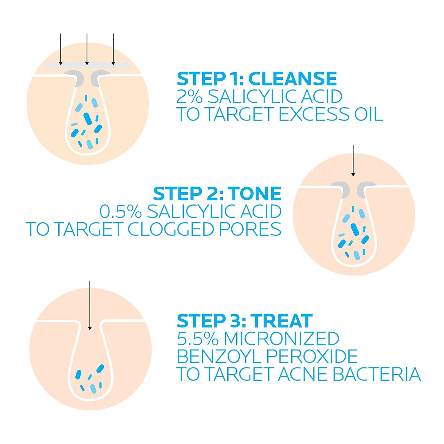 La Roche-Posay Effaclar Dermatological 3-Step Acne Treatment System