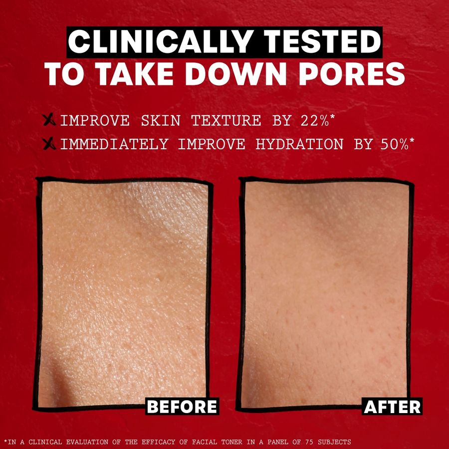 Thayers Rose Petal Witch Hazel Facial Toner Mist