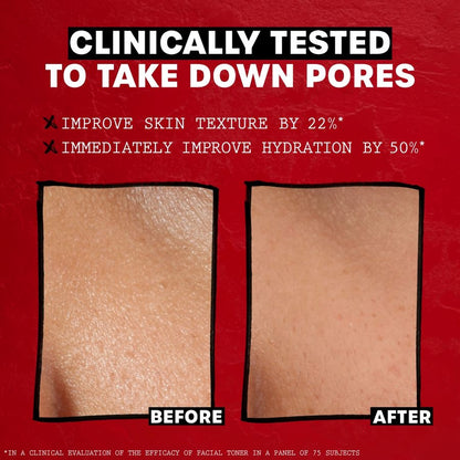 Thayers Rose Petal Witch Hazel Facial Toner Mist